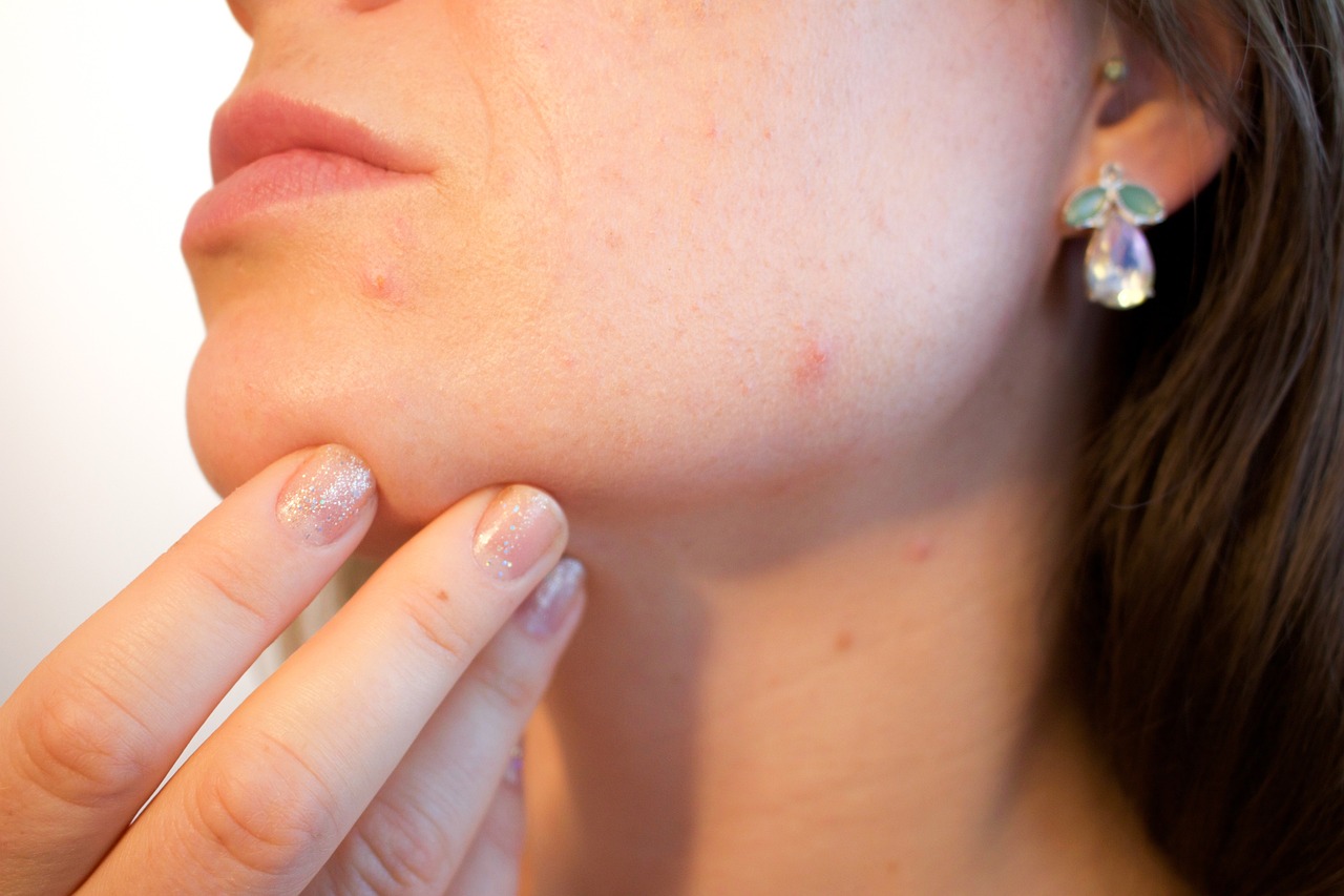 Cosa serve per andare dal dermatologo?