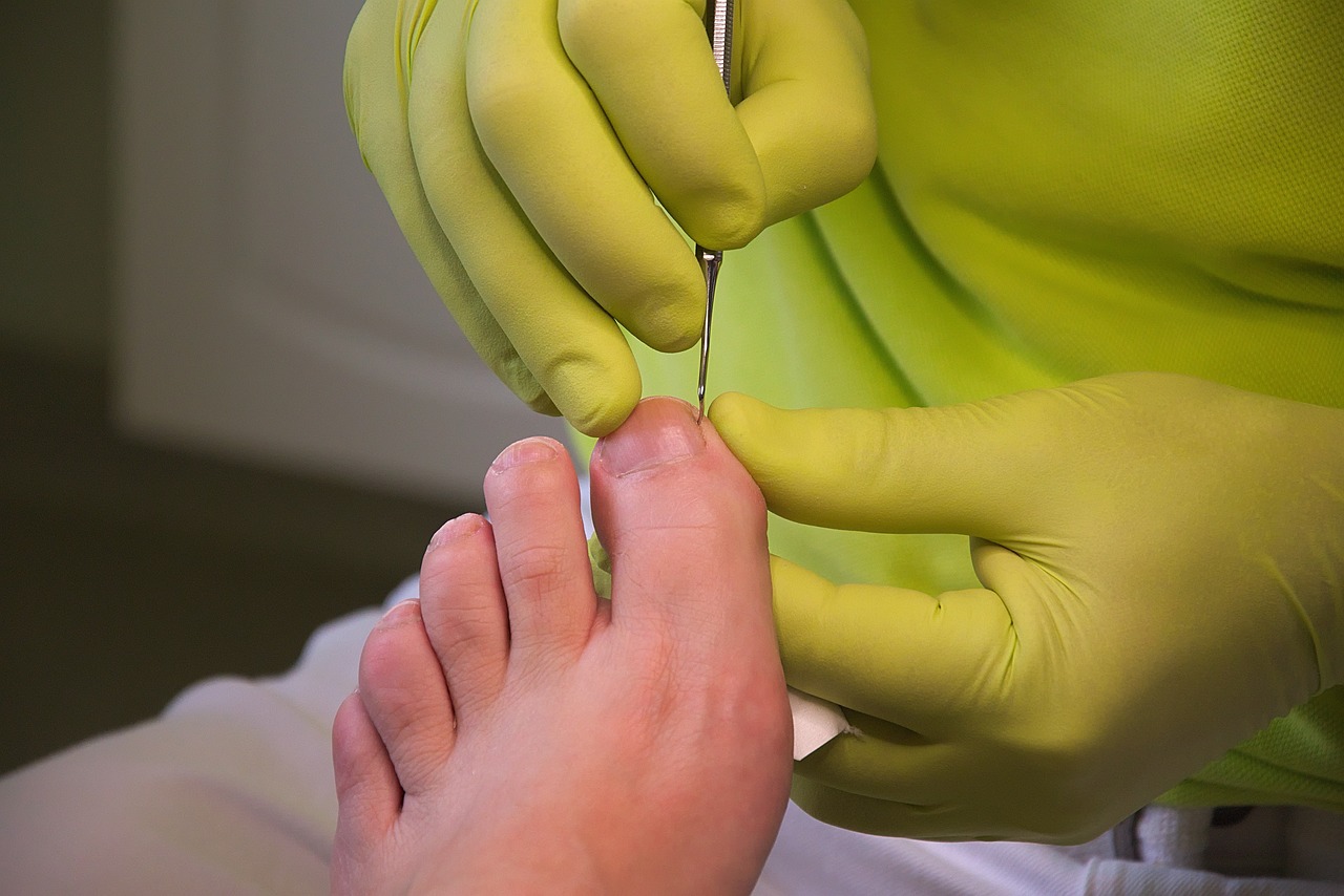 Quali patologie del piede cura il podologo?
